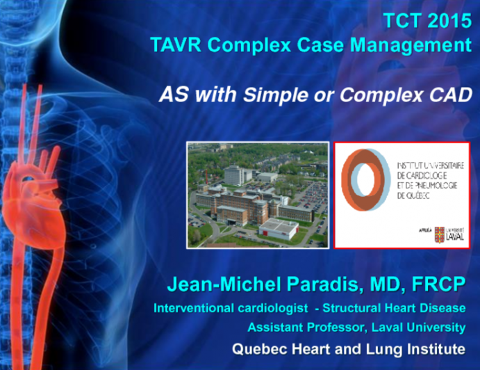 Aortic Stenosis With Simple and Complex CAD: Case Presentation