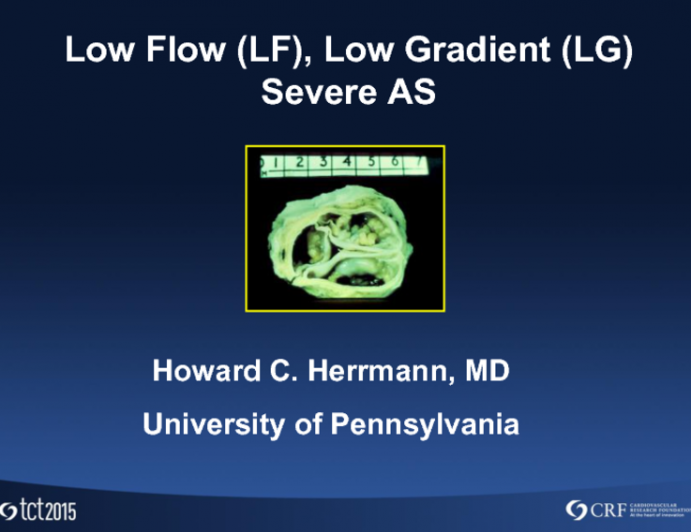 Low Flow: Low-Gradient Aortic Stenosis and TAVR  Thoughtful Commentary on the Case