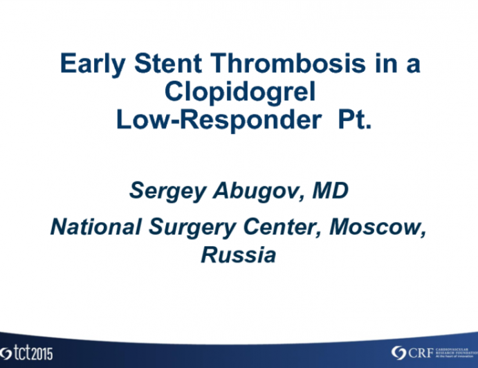 Russia Presents: A Case of Early Stent Thrombosis in a Clopidogrel Low-Responder Patient