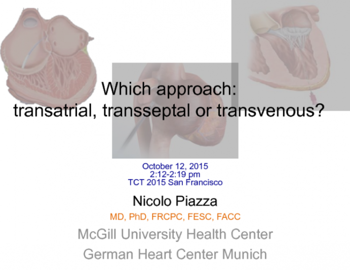 Access Site Alternatives for Transcatheter MV Replacement: Transatrial, Transapical, or Transeptal?