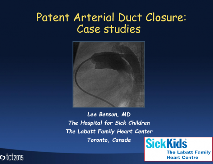 Two Illustrative Cases of PDA Closure: One Simple and One Large and Complex