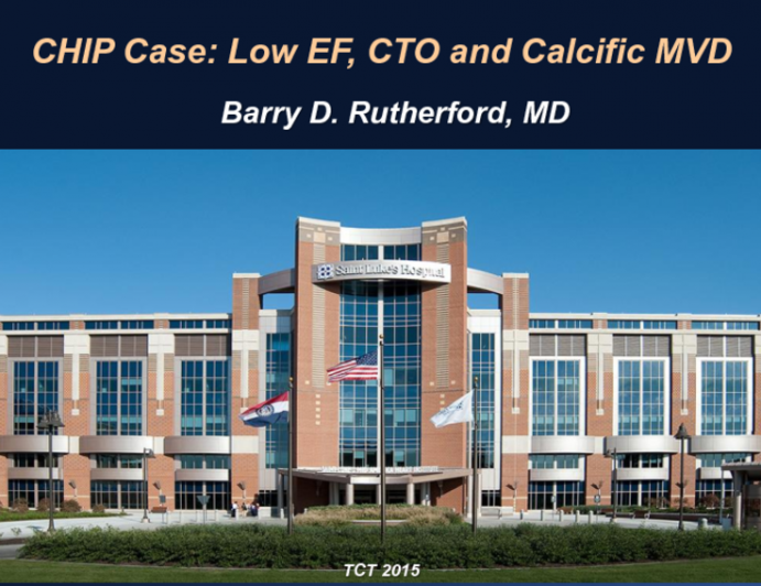 CHIP Case: Low EF, CTO, and Calcific MVD