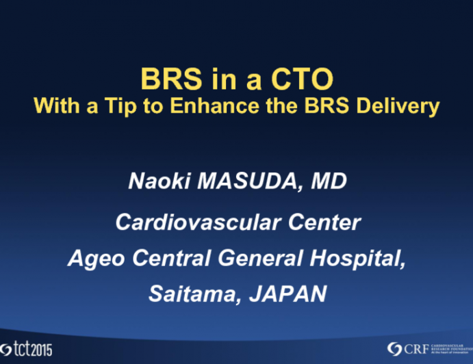 BRS in a CTO (With a Tip to Enhance the BRS Delivery)