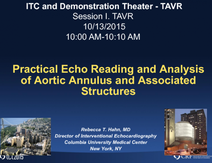 Practical Echo Reading and Analysis of Aortic Annulus and Associated Structures