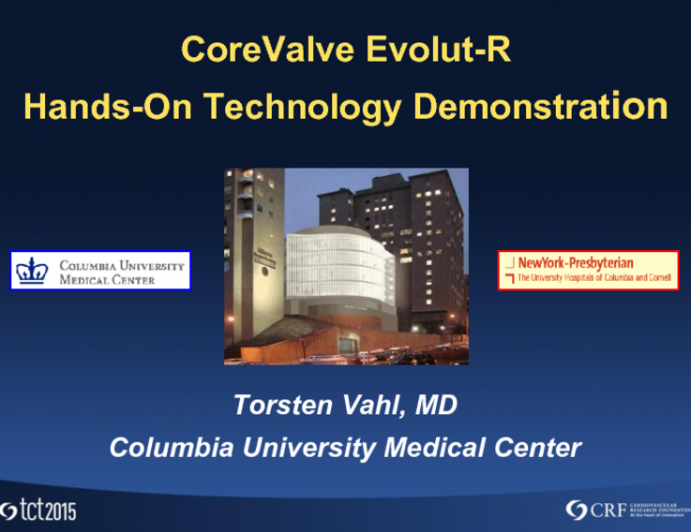 CoreValve Evolut R (Medtronic)