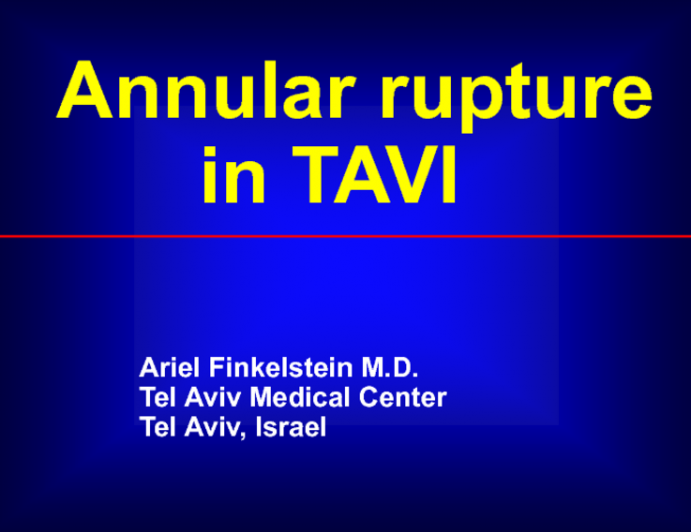 Presentation From Israel: Annular Rupture During TAVI