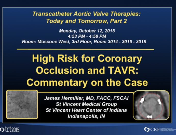 High Risk for Coronary Occlusion and TAVR: Thoughtful Commentary on the Case