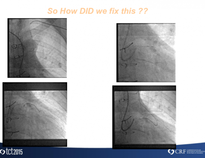 Ireland Presents: How Did I Treat This Case?