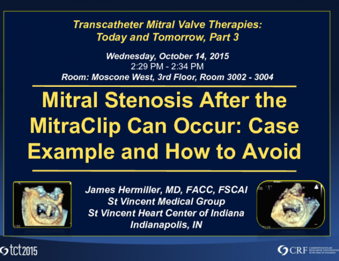 Mitral Stenosis After the MitraClip Can Occur: Case Example and How to Avoid