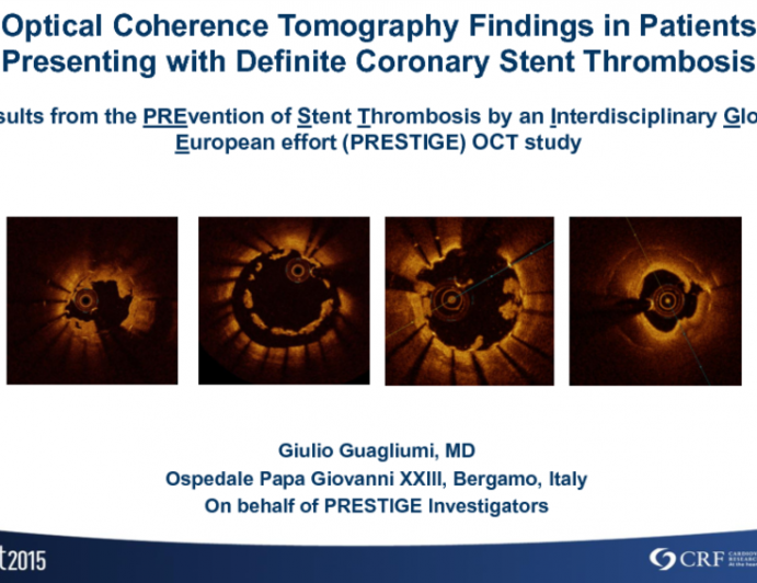 PRESTIGE: Optical Coherence Tomography Findings in Patients Presenting With Stent Thrombosis