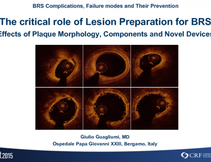 The Critical Role of Lesion Preparation for BRS: Effects of Plaque Morphology, Components, and Novel Devices