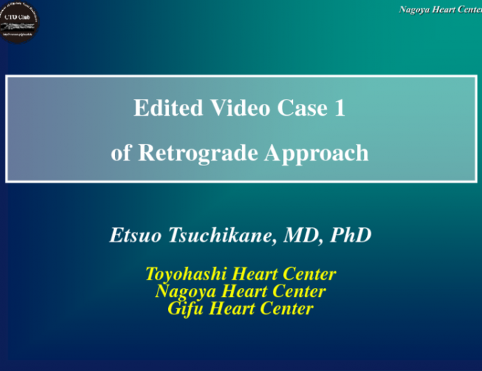 Edited Video Case 1 of Retrograde Approach