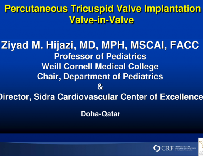 Transcatheter Valve-in-Valve (Tricuspid Position)