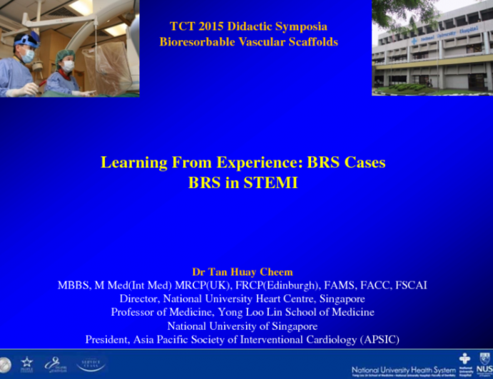 BRS in STEMI