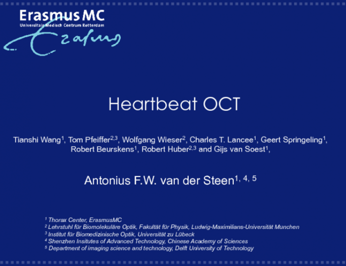 OCT Technological Trends 2: Heart-Beat OCT  Micro Motor System Technology