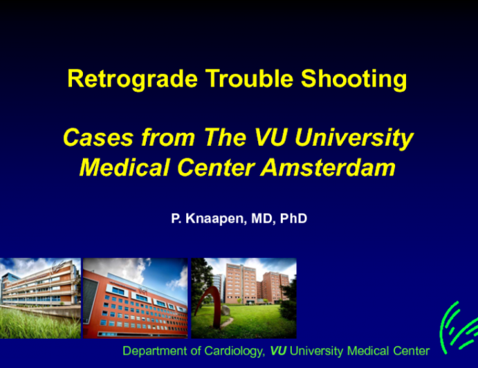 Edited Video Case 2 of Retrograde Approach