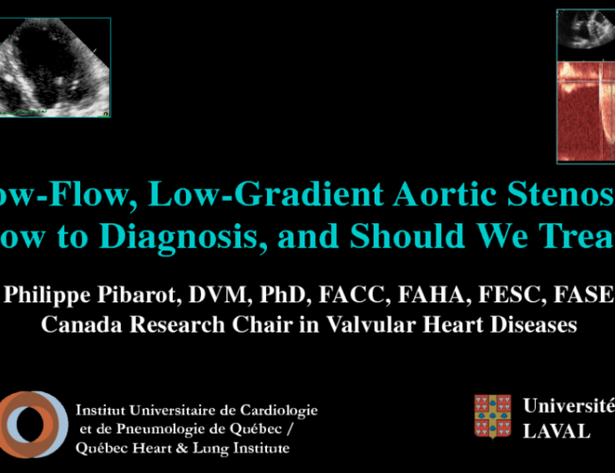 Low-Flow, Low-Gradient Aortic Stenosis: How to Diagnosis, and Should We Treat?