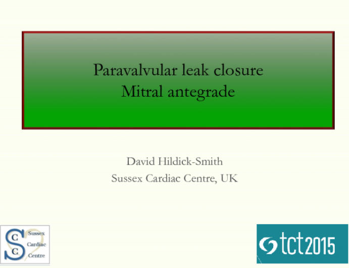 Case 1: Mitral Paravalvular Leak Closure  Antegrade Approach