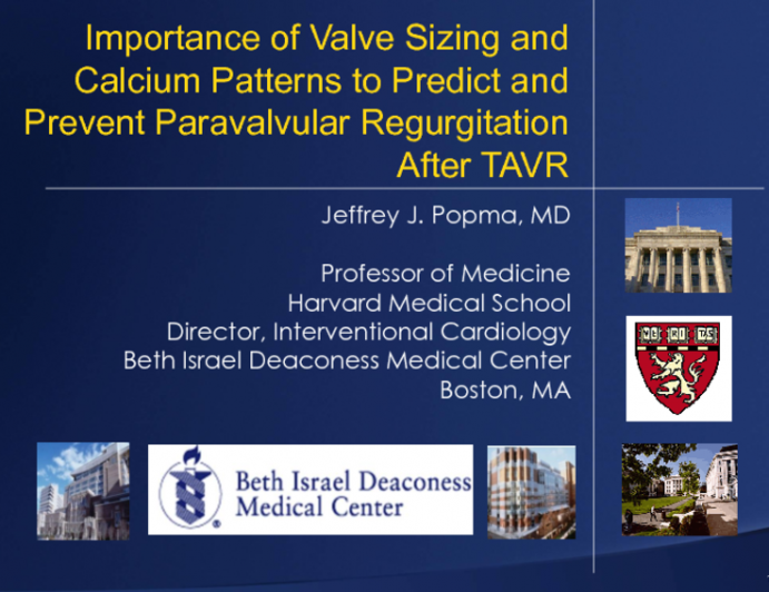 Paravalvular Regurgitation After TAVR 2: Importance of Valve Sizing and Calcium Patterns to Predict and Prevent Paravalvular Regurgitation After TAVR