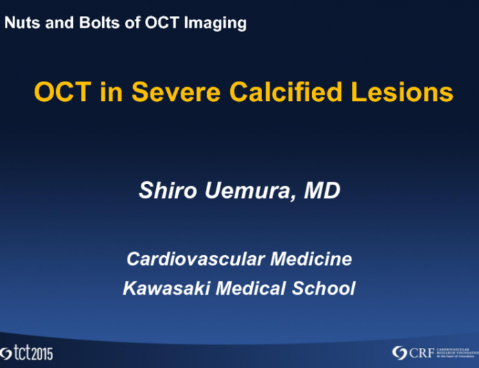 OCT in Severe Calcified Lesions