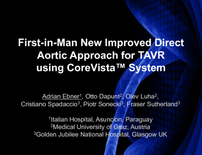 First-in-Man New Improved Direct Aortic Approach for TAVR using CoreVista System