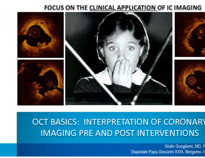 OCT Basics: Interpretation of Coronary Imaging Pre and Post Interventions