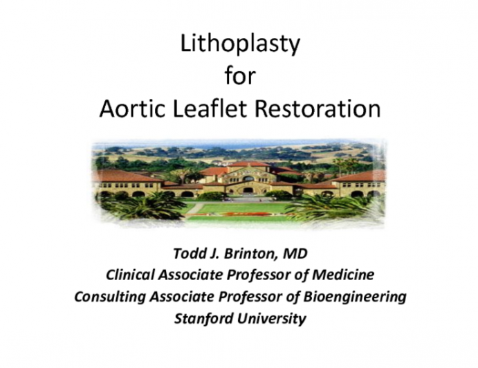 Lithoplasty for Aortic Leaflet Restoration