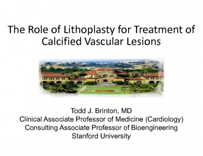 The Role of Lithoplasty for Treatment of Calcified Vascular Lesions