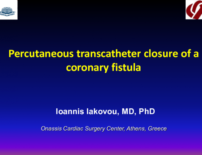 Percutaneous transcatheter closure of a coronary fistula