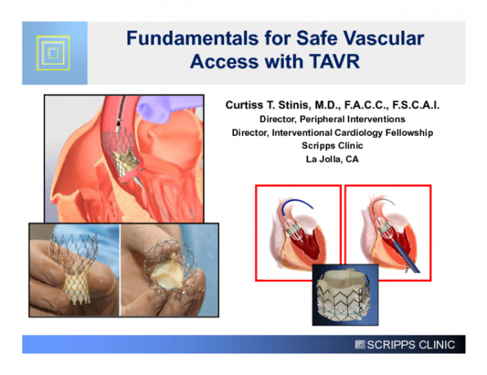 Fundamentals for Safe Vascular Access with TAVR