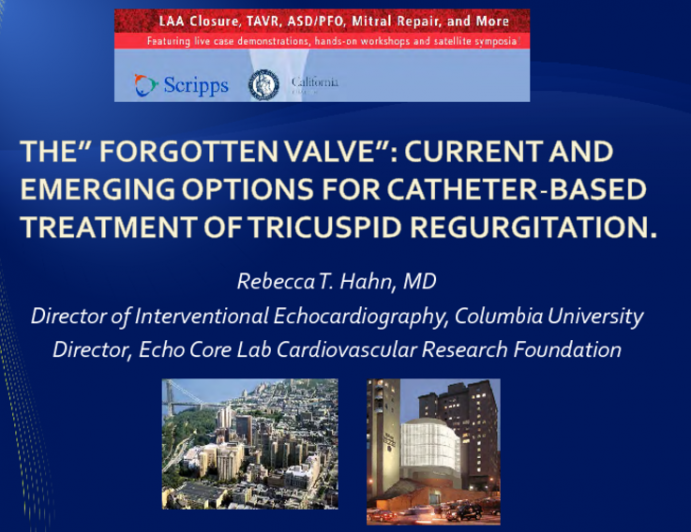The “Forgotten Valve”: Current and Emerging  Options for Catheter Based Treatment of  Tricuspid Regurgitation