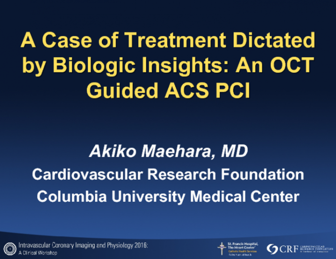 A Case of Treatment Dictated by Biologic Insights: An OCT Guided ACS PCI