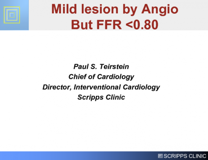 Mild Lesion by Angio But FFR Less Than 0.80