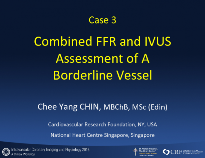 Combined FFR and IVUSAssessment of ABorderline Vessel