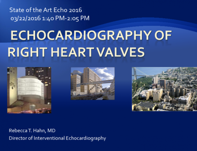 Echocardiolgraphy Of Right Heart Valves