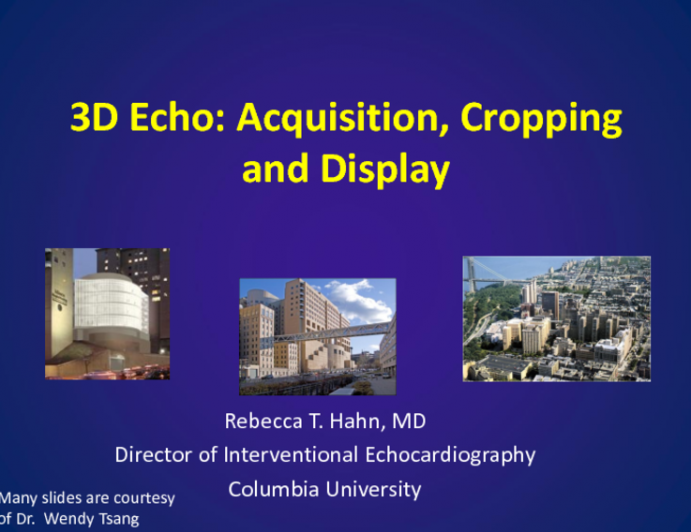 3D Echo: Acquisition, Cropping and Display