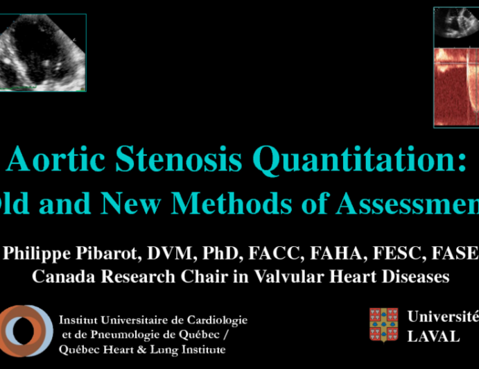 Aortic Stenosis Quantitation: Old and New Methods of Assessment