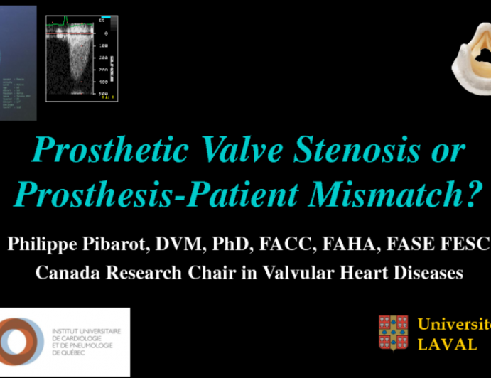 Prosthetic Valve Stenosis or Prosthesis-Patient Mismatch?