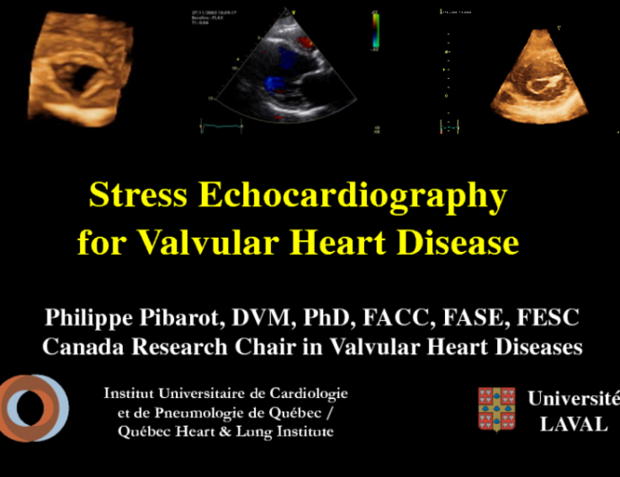 Stress Echocardiography For Valvular Heart Disease | Tctmd.com