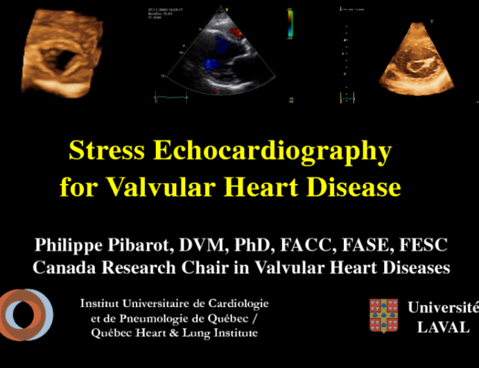 Stress Echocardiography for Valvular Heart Disease