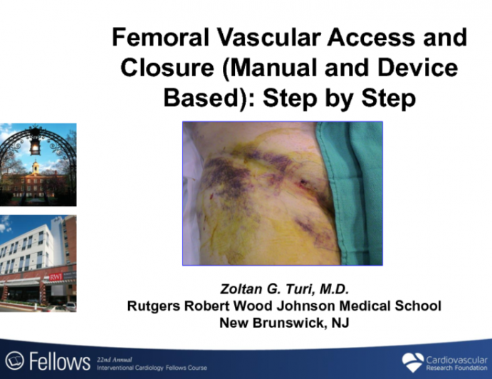 Femoral Vascular Access and Closure (Manual and Device Based): A Step-by-Step Approach