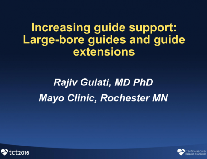 Increasing Guide Support: Large Bore Guides and Guide Extensions