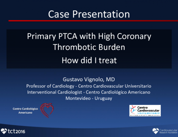 Case 1: Primary PTCA With High Thrombotic Burden: How Did I Treat it?