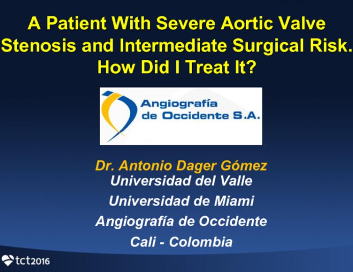 Case 4: A Patient With Severe Aortic Valve Stenosis and Intermediate Surgical Risk. How Did I Treat It?