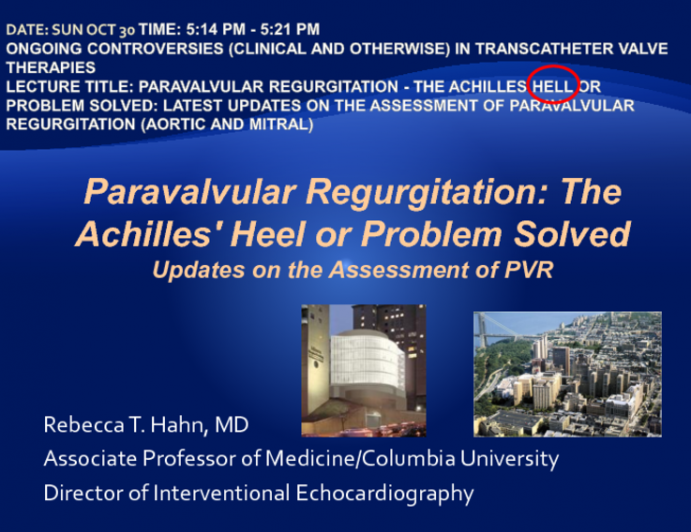 Paravalvular Regurgitation - The Achilles Heel or Problem Solved: Latest Updates on the Assessment of Paravalvular Regurgitation (Aortic and Mitral)
