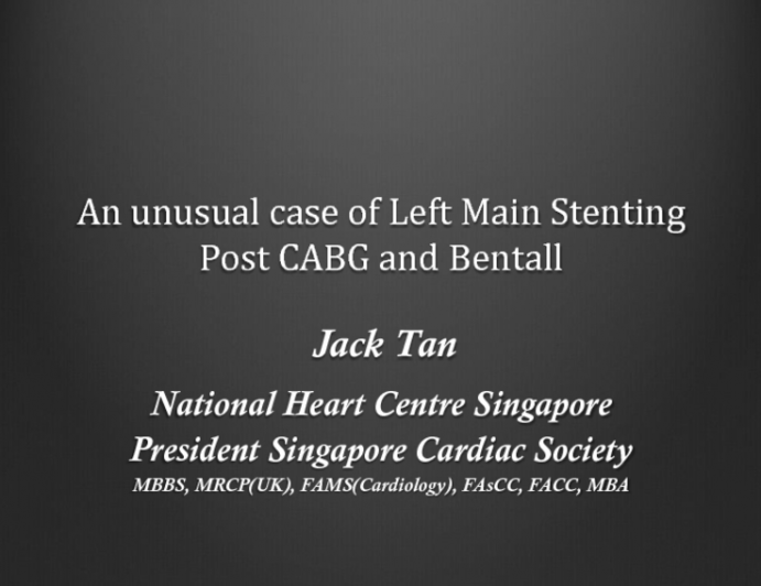 Singapore Presents a Case: Complex PCI