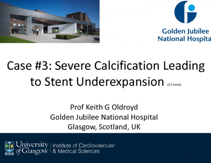 Case #3: Severe Calcification Leading to Stent Underexpansion