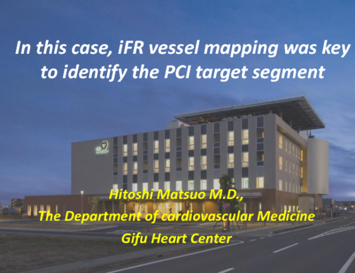 In This Case: iFR Vessel Mapping Was Key to Identify the PCI Target Segment