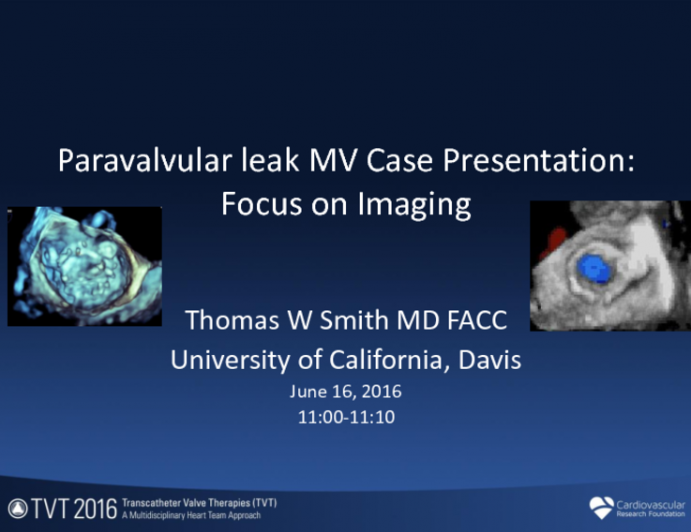 PVL MV Case Presentation: Focus on Imaging