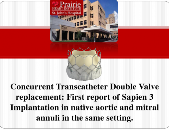 TVT 1036: Concurrent Transcatheter Double Valve Replacement: First Report of Sapien 3 Implantation in Native Aortic and Mitral Annuli in the Same Setting